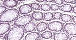 FUS Antibody in Immunohistochemistry (Paraffin) (IHC (P))