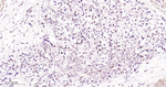 FUS Antibody in Immunohistochemistry (Paraffin) (IHC (P))