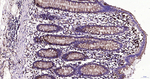 LAMP1 Antibody in Immunohistochemistry (Paraffin) (IHC (P))