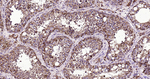 LAMP1 Antibody in Immunohistochemistry (Paraffin) (IHC (P))
