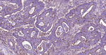 LAMP1 Antibody in Immunohistochemistry (Paraffin) (IHC (P))