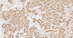 EBP50 Antibody in Immunohistochemistry (Paraffin) (IHC (P))