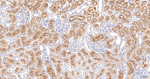 EBP50 Antibody in Immunohistochemistry (Paraffin) (IHC (P))