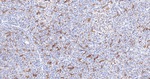 EBP50 Antibody in Immunohistochemistry (Paraffin) (IHC (P))