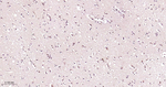 SP1 Antibody in Immunohistochemistry (Paraffin) (IHC (P))