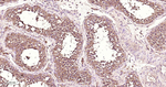 PDIA6 Antibody in Immunohistochemistry (Paraffin) (IHC (P))