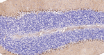 S100A6 Antibody in Immunohistochemistry (Paraffin) (IHC (P))