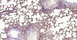 S100A6 Antibody in Immunohistochemistry (Paraffin) (IHC (P))