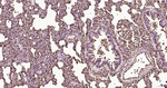 S100A6 Antibody in Immunohistochemistry (Paraffin) (IHC (P))