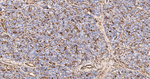 S100A6 Recombinant Rabbit Monoclonal Antibody (15A11)