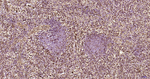 S100A6 Antibody in Immunohistochemistry (Paraffin) (IHC (P))