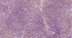 S100A6 Antibody in Immunohistochemistry (Paraffin) (IHC (P))