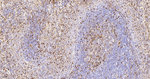 S100A6 Antibody in Immunohistochemistry (Paraffin) (IHC (P))