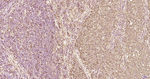 S100A6 Antibody in Immunohistochemistry (Paraffin) (IHC (P))