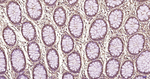 S100A6 Antibody in Immunohistochemistry (Paraffin) (IHC (P))