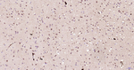S100A6 Antibody in Immunohistochemistry (Paraffin) (IHC (P))