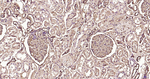 S100A6 Antibody in Immunohistochemistry (Paraffin) (IHC (P))