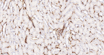 S100A6 Antibody in Immunohistochemistry (Paraffin) (IHC (P))