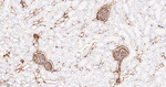 S100A6 Antibody in Immunohistochemistry (Paraffin) (IHC (P))