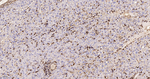 S100A6 Antibody in Immunohistochemistry (Paraffin) (IHC (P))