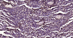 S100A6 Antibody in Immunohistochemistry (Paraffin) (IHC (P))