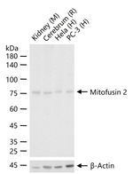 MFN2 Recombinant Rabbit Monoclonal Antibody (2D17)