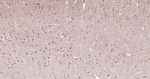 Parkin Antibody in Immunohistochemistry (Paraffin) (IHC (P))