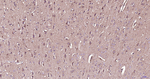 Parkin Antibody in Immunohistochemistry (Paraffin) (IHC (P))