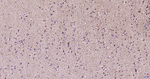 Parkin Antibody in Immunohistochemistry (Paraffin) (IHC (P))