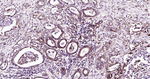 Parkin Recombinant Rabbit Monoclonal Antibody (9G5)