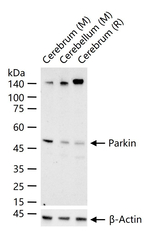 Parkin Antibody in Western Blot (WB)