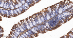 S100A10 Antibody in Immunohistochemistry (Paraffin) (IHC (P))
