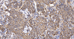S100A10 Antibody in Immunohistochemistry (Paraffin) (IHC (P))
