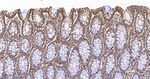 S100A10 Antibody in Immunohistochemistry (Paraffin) (IHC (P))