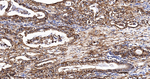 S100A10 Recombinant Rabbit Monoclonal Antibody (8B12)