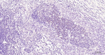 DNMT1 Antibody in Immunohistochemistry (Paraffin) (IHC (P))