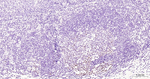 DNMT1 Antibody in Immunohistochemistry (Paraffin) (IHC (P))