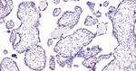 DNMT1 Antibody in Immunohistochemistry (Paraffin) (IHC (P))
