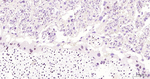 DNMT1 Antibody in Immunohistochemistry (Paraffin) (IHC (P))