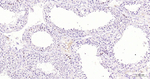DNMT1 Antibody in Immunohistochemistry (Paraffin) (IHC (P))