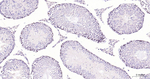 DNMT1 Antibody in Immunohistochemistry (Paraffin) (IHC (P))