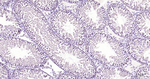 DNMT1 Antibody in Immunohistochemistry (Paraffin) (IHC (P))