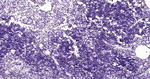 DNMT1 Antibody in Immunohistochemistry (Paraffin) (IHC (P))