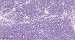 DNMT1 Antibody in Immunohistochemistry (Paraffin) (IHC (P))