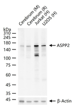 53BP2 Recombinant Rabbit Monoclonal Antibody (6C2)