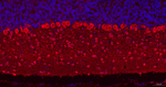 Parvalbumin Recombinant Rabbit Monoclonal Antibody (11H20)