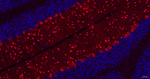 Parvalbumin Antibody in Immunohistochemistry (Paraffin) (IHC (P))