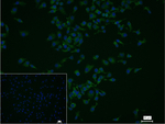 SERCA2 ATPase Recombinant Rabbit Monoclonal Antibody (13G1)