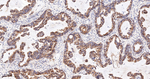 SERCA2 ATPase Antibody in Immunohistochemistry (Paraffin) (IHC (P))