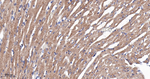 SERCA2 ATPase Antibody in Immunohistochemistry (Paraffin) (IHC (P))